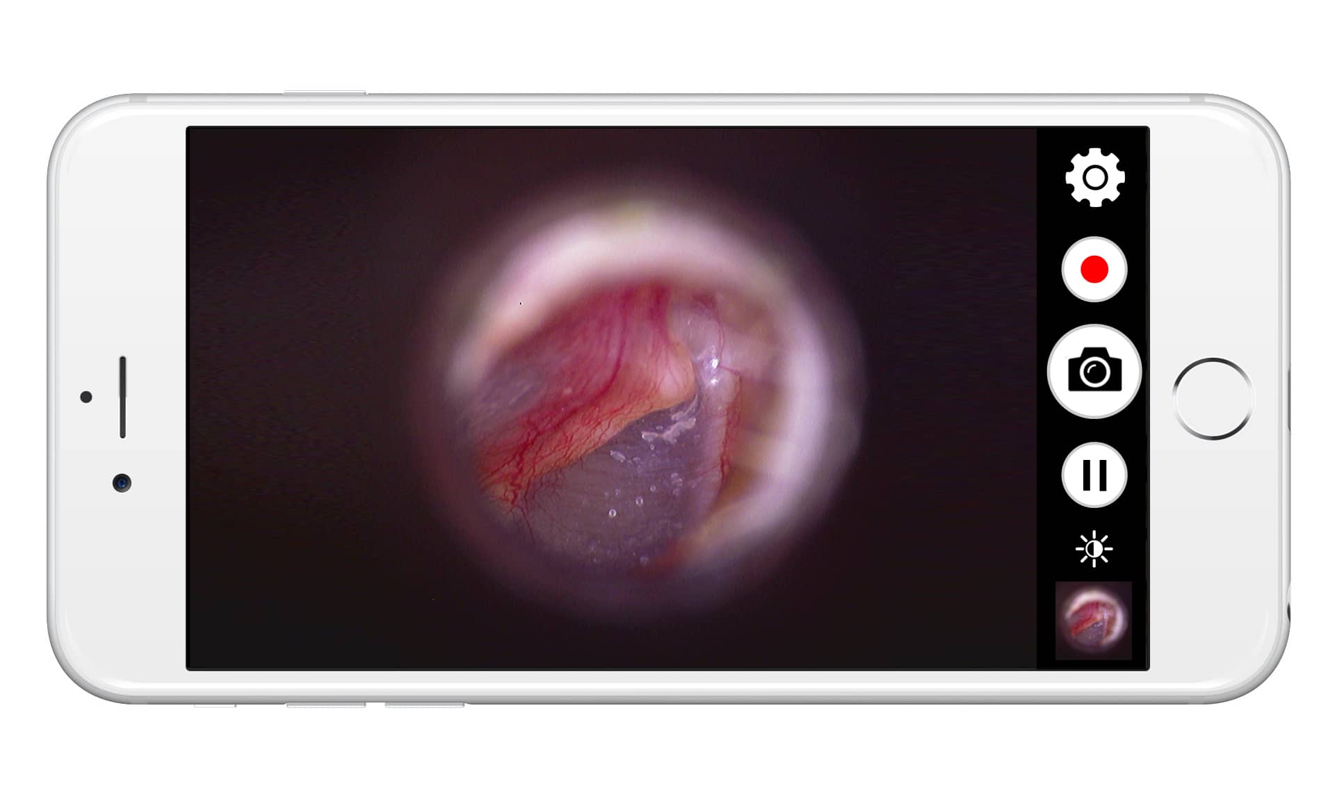 FireFly™ Veterinary Video Otoscope - Bluetooth-like - Image 2