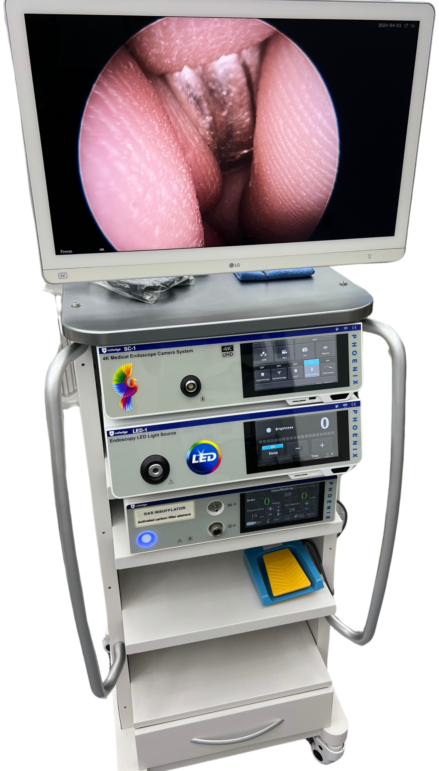 Medical endoscopic system displaying vocal cords