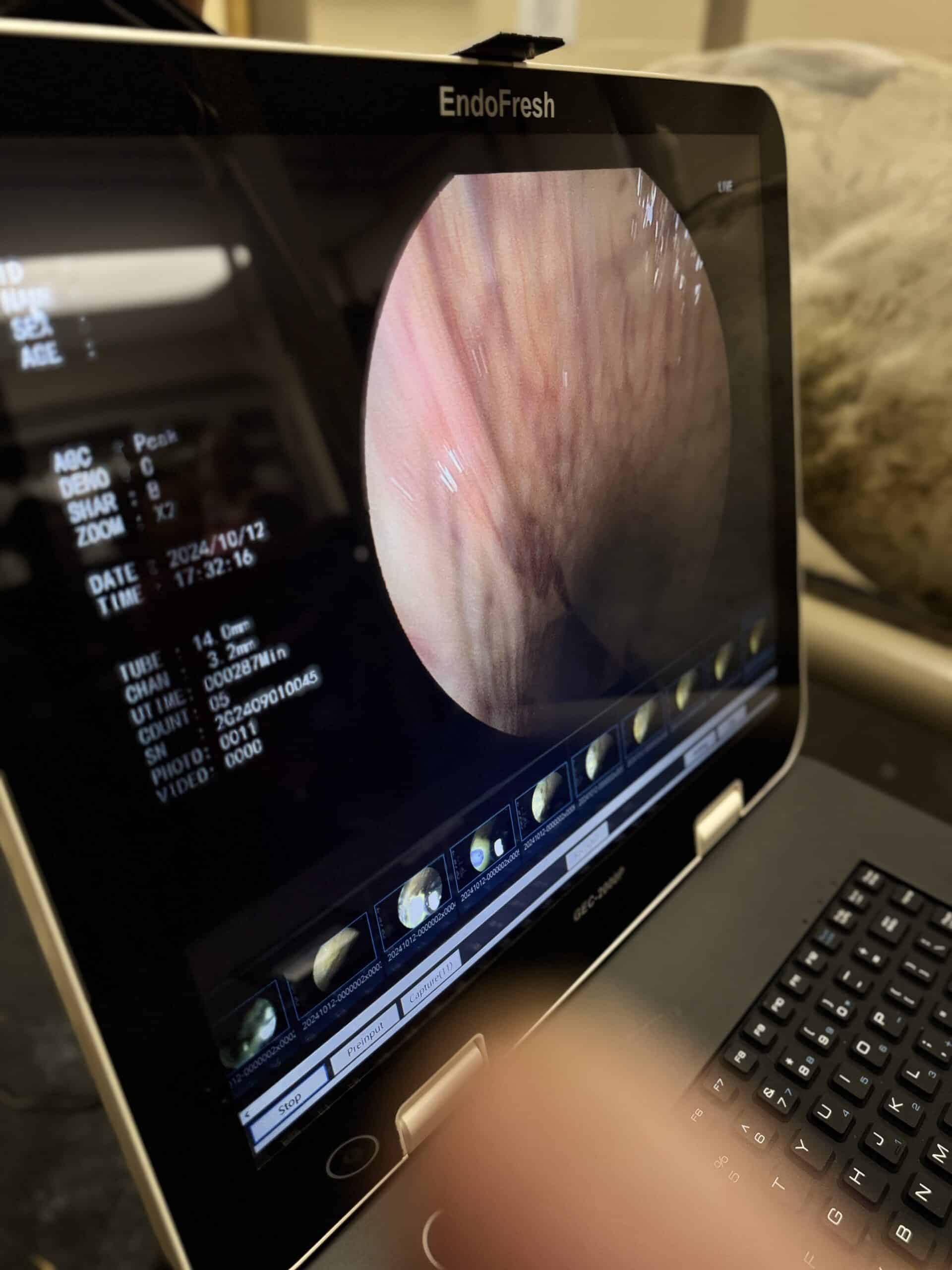 Endoscopic image on EndoFresh monitor