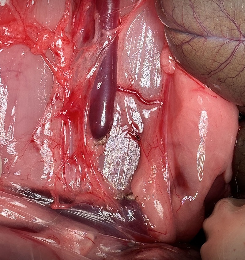 Close-up of human internal organs during surgery