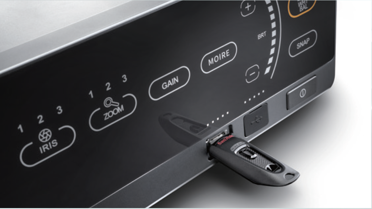 SonoScape veterinary surgery, SonoScape 4K endoscopy, veterinary surgical endoscopy system, 4K MIS endoscope for vets, veterinary laparoscopy 4K, veterinary arthroscopy 4K, rigid endoscope veterinary, small animal surgical endoscopy, equine surgical endoscope, advanced veterinary surgery imaging, high-definition veterinary endoscopy, 4K surgical video system vet, veterinary minimally invasive surgery equipment, veterinary operating room imaging, vet med surgical endoscope platform, buy veterinary surgical endoscope, SonoScape endoscopy for sale, veterinary hospital surgery equipment, zoo medicine surgical endoscopy, veterinary GI surgery endoscope, veterinary ortho endoscopy, veterinary thoracoscopy 4K, veterinary abdominal surgery imaging, MIS equipment for veterinarians