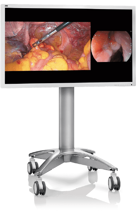 SonoScape veterinary surgery, SonoScape 4K endoscopy, veterinary surgical endoscopy system, 4K MIS endoscope for vets, veterinary laparoscopy 4K, veterinary arthroscopy 4K, rigid endoscope veterinary, small animal surgical endoscopy, equine surgical endoscope, advanced veterinary surgery imaging, high-definition veterinary endoscopy, 4K surgical video system vet, veterinary minimally invasive surgery equipment, veterinary operating room imaging, vet med surgical endoscope platform, buy veterinary surgical endoscope, SonoScape endoscopy for sale, veterinary hospital surgery equipment, zoo medicine surgical endoscopy, veterinary GI surgery endoscope, veterinary ortho endoscopy, veterinary thoracoscopy 4K, veterinary abdominal surgery imaging, MIS equipment for veterinarians