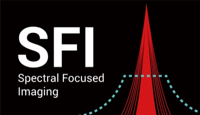 SonoScape veterinary surgery, SonoScape 4K endoscopy, veterinary surgical endoscopy system, 4K MIS endoscope for vets, veterinary laparoscopy 4K, veterinary arthroscopy 4K, rigid endoscope veterinary, small animal surgical endoscopy, equine surgical endoscope, advanced veterinary surgery imaging, high-definition veterinary endoscopy, 4K surgical video system vet, veterinary minimally invasive surgery equipment, veterinary operating room imaging, vet med surgical endoscope platform, buy veterinary surgical endoscope, SonoScape endoscopy for sale, veterinary hospital surgery equipment, zoo medicine surgical endoscopy, veterinary GI surgery endoscope, veterinary ortho endoscopy, veterinary thoracoscopy 4K, veterinary abdominal surgery imaging, MIS equipment for veterinarians