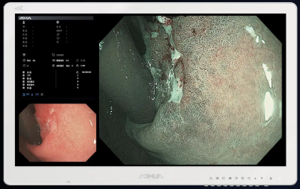 AOHUA veterinary endoscopy, AOHUA vet endoscope, AOHUA veterinary endoscope, AOHUA endoscopy system, AOHUA endoscopy tower, AOHUA 4K veterinary endoscopy, AOHUA FHD veterinary endoscopy, AOHUA video endoscope, AOHUA veterinary imaging system, AOHUA endoscopy processor, AOHUA rigid endoscope veterinary, AOHUA flexible endoscope veterinary, AOHUA veterinary endoscopy equipment, AOHUA endoscopy systems for sale, AOHUA veterinary endoscopy USA, AOHUA veterinary endoscopy North America, veterinary endoscopy system AOHUA, buy AOHUA veterinary endoscope, AOHUA endoscopy pricing, AOHUA veterinary endoscopy distributor, AOHUA veterinary endoscopy dealer, AOHUA vet endoscopy supplier, AOHUA veterinary endoscopy support, AOHUA veterinary endoscopy training, AOHUA veterinary endoscopy installation, AOHUA veterinary endoscopy accessories, AOHUA endoscope repair veterinary, AOHUA endoscope service USA, veterinary endoscopy equipment for sale, veterinary endoscopy systems USA, veterinary endoscope supplier North America, veterinary video endoscopy system, veterinary FHD endoscopy, veterinary 4K endoscopy system, veterinary surgical endoscopy AOHUA, veterinary laparoscopy system AOHUA, veterinary arthroscopy system AOHUA, equine endoscopy AOHUA, equine gastroscope AOHUA, equine airway endoscopy AOHUA, equine bladder endoscopy AOHUA, equine internal medicine endoscopy, small animal endoscopy AOHUA, small animal GI endoscopy system, small animal airway endoscopy, veterinary ENT endoscopy AOHUA, veterinary rhinoscopy system, veterinary bronchoscopy system, zoo animal endoscopy AOHUA, exotic animal endoscopy system, aquarium veterinary endoscopy, wildlife veterinary endoscopy, multi-species veterinary endoscopy, veterinary teaching hospital endoscopy system, veterinary referral hospital endoscopy, ambulatory veterinary endoscopy system, portable veterinary endoscopy AOHUA, veterinary endoscopy for emergency medicine, veterinary foreign body retrieval endoscopy, veterinary diagnostic endoscopy, veterinary minimally invasive imaging, veterinary endoscopy image quality, veterinary endoscopy CMOS sensor, veterinary endoscopy LED illumination, veterinary endoscopy video capture, veterinary endoscopy DICOM compatible, veterinary endoscopy clinical workflow, veterinary endoscopy biosecurity solutions, veterinary endoscopy reprocessing compatibility, veterinary endoscopy system comparison, AOHUA vs other veterinary endoscopy systems, best veterinary endoscopy systems, advanced veterinary endoscopy technology, veterinary endoscopy financing options, veterinary endoscopy capital equipment, veterinary endoscopy upgrade system